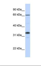 721_B cell lysate. Antibody concentration: 1.0 ug/ml. Gel concentration: 12%.
