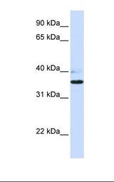 Fetal heart lysate. Antibody concentration: 1.0 ug/ml. Gel concentration: 12%.