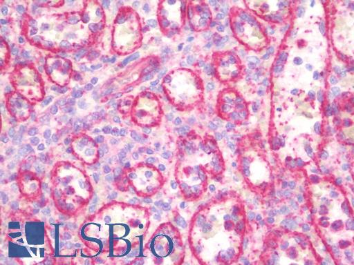 Human Spleen: Formalin-Fixed, Paraffin-Embedded (FFPE)