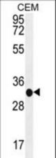 B3GAT3 Antibody western blot of CEM cell line lysates (35 ug/lane). The B3GAT3 antibody detected the B3GAT3 protein (arrow).