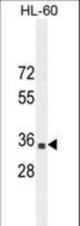 B3GNT4 Antibody western blot of HL-60 cell line lysates (35 ug/lane). The B3GNT4 antibody detected the B3GNT4 protein (arrow).