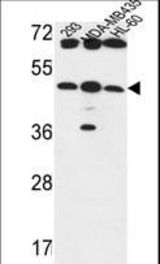 B3GNT5 Antibody western blot of 293,MDA-MB435,HL-60 cell line lysates (35 ug/lane). The B3GNT5 antibody detected the B3GNT5 protein (arrow).