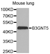 Western blot analysis of extracts of Mouse lung cell line, using B3GNT5 antibody.
