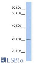 B3GNT6 antibody Western Blot of PANC1. Antibody dilution: 1 ug/ml.
