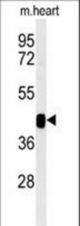 Western blot of B3GNT7 Antibody in mouse heart tissue lysates (35 ug/lane). B3GNT7 (arrow) was detected using the purified antibody.