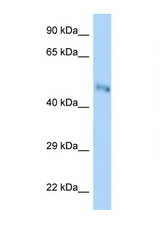B3GNT7 antibody LS-C146139 Western blot of Mouse Kidney lysate. Antibody concentration 1 ug/ml.
