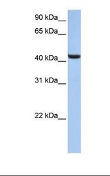 HepG2 cell lysate. Antibody concentration: 1.0 ug/ml. Gel concentration: 12%.