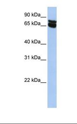 HepG2 cell lysate. Antibody concentration: 1.0 ug/ml. Gel concentration: 12%.