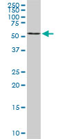 B4GALNT1 monoclonal antibody (M02), clone 5F9. Western Blot analysis of B4GALNT1 expression in PC-12.