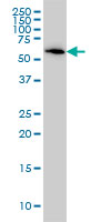 B4GALNT1 monoclonal antibody (M02), clone 5F9 Western Blot analysis of B4GALNT1 expression in HeLa.