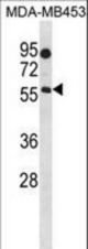 B4GALNT1 Antibody western blot of MDA-MB453 cell line lysates (35 ug/lane). The B4GALNT1 antibody detected the B4GALNT1 protein (arrow).
