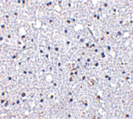 Immunohistochemistry of DARC in human brain tissue with DARC antibody at 5 ug/ml.