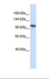 Hela cell lysate. Antibody concentration: 1.0 ug/ml. Gel concentration: 6-18%.