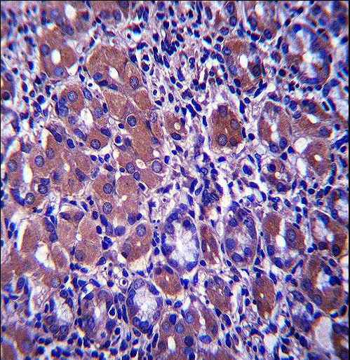 B4GALNT3 Antibody immunohistochemistry of formalin-fixed and paraffin-embedded human stomach tissue followed by peroxidase-conjugated secondary antibody and DAB staining.