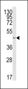 Western blot of B4GalT1 Antibody in HL-60 cell line lysates (35 ug/lane). B4GALT1 (arrow) was detected using the purified antibody.