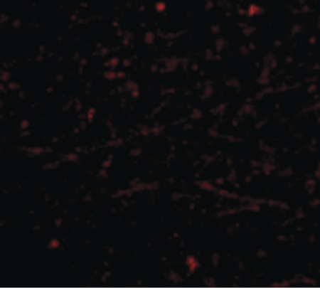 Immunofluorescence of DARC in Human Brain cells with DARC antibody at 20 ug/ml.