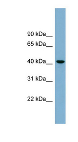 B4GALT2 antibody LS-C110954 Western blot of OVCAR-3 cell lysate.