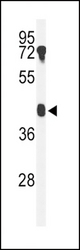 Western blot of B4GALT2 Antibody in mouse testis tissue lysates (35 ug/lane). B4GALT2 (arrow) was detected using the purified antibody.