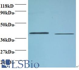 Western blot of Beta-1,4-galactosyltransferase 3 antibody at 2 ug/ml. Lane 1: EC109 whole cell lysate. Lane 2: 293T whole cell lysate. Secondary: Goat polyclonal to Rabbit IgG at 1:15000 dilution. Predicted band size: 43 kDa. Observed band size: 43 kDa.