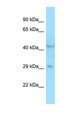 B4GALT3 antibody LS-C146410 Western blot of Rat Liver lysate. Antibody concentration 1 ug/ml.