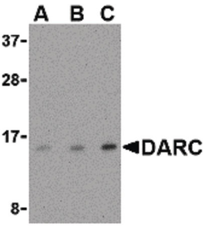 Western blot of DARC in PC-3 cell lysate with DARC antibody at (A) 0.5, (B) 1 and (C) 2 ug/ml.