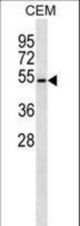 B4GALT4 Antibody western blot of CEM cell line lysates (35 ug/lane). The B4GALT4 antibody detected the B4GALT4 protein (arrow).