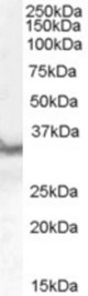Antibody staining (0.3 ug/ml) of Human Heart lysate (RIPA buffer, 30 ug total protein per lane). Primary incubated for 1 hour. Detected by Western blot of chemiluminescence.