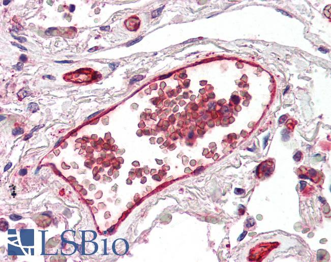 Anti-DARC antibody IHC of human lung, vessel. Immunohistochemistry of formalin-fixed, paraffin-embedded tissue after heat-induced antigen retrieval. Antibody LS-B2393 concentration 5 ug/ml.
