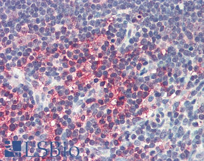 Anti-PD-L1 antibody IHC of human thymus. Immunohistochemistry of formalin-fixed, paraffin-embedded tissue after heat-induced antigen retrieval. Antibody LS-B480 concentration 5 ug/ml.
