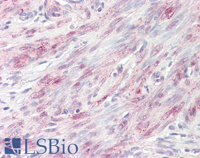 Anti-BABAM1 / HSPC142 antibody IHC of human uterus. Immunohistochemistry of formalin-fixed, paraffin-embedded tissue after heat-induced antigen retrieval. Antibody LS-B8224 dilution 5-7.5 ug/ml.
