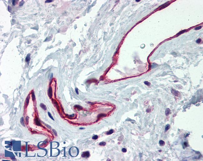 Anti-DARC antibody IHC of human colon, vessels. Immunohistochemistry of formalin-fixed, paraffin-embedded tissue after heat-induced antigen retrieval. Antibody LS-B2306 concentration 5 ug/ml.