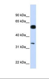 Hela cell lysate. Antibody concentration: 1.0 ug/ml. Gel concentration: 12%.