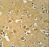 HSPC142 Antibody immunohistochemistry of formalin-fixed and paraffin-embedded human brain tissue followed by peroxidase-conjugated secondary antibody and DAB staining.
