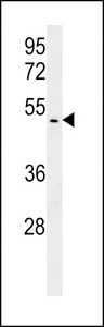 HSPC142 Antibody western blot of T47D cell line lysates (15 ug/lane). The HSPC142 antibody detected the HSPC142 protein (arrow).