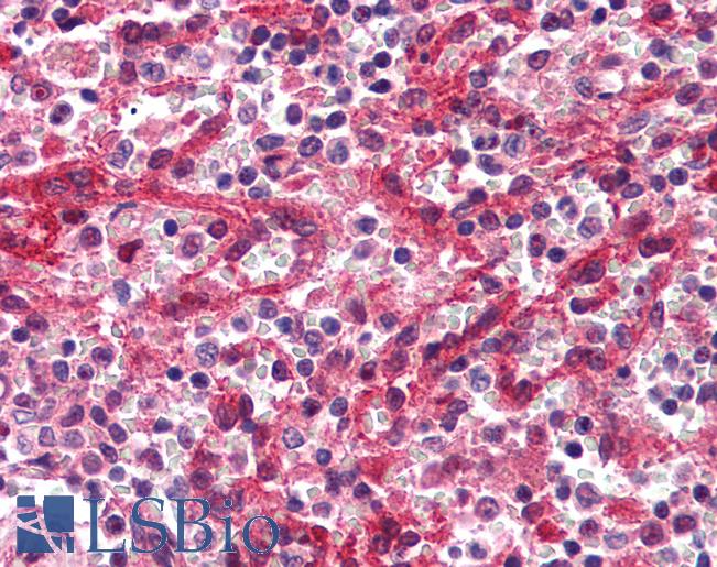 Anti-DARC antibody IHC of human spleen, red pulp. Immunohistochemistry of formalin-fixed, paraffin-embedded tissue after heat-induced antigen retrieval. Antibody LS-B2306 concentration 5 ug/ml.
