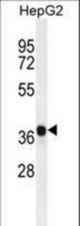 AKR1C2 Antibody western blot of HepG2 cell line lysates (35 ug/lane). The AKR1C2 antibody detected the AKR1C2 protein (arrow).