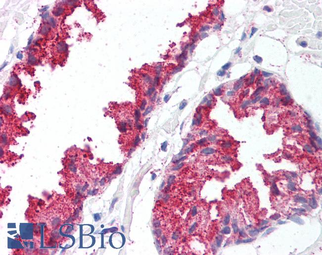 Anti-BACE1 antibody LS-A8549 IHC of human prostate. Immunohistochemistry of formalin-fixed, paraffin-embedded tissue after heat-induced antigen retrieval.