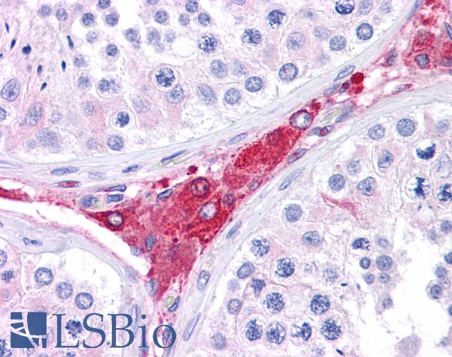 Anti-BACE1 antibody IHC of human testis. Immunohistochemistry of formalin-fixed, paraffin-embedded tissue after heat-induced antigen retrieval. Antibody LS-B4664 concentration 5 ug/ml.