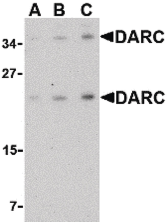 Western blot of DARC in mouse brain tissue lysate with DARC antibody at (A) 0.5, (B) 1 and (C) 2 ug/ml.