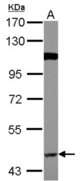 Sample (30 ug of whole cell lysate) A: A549 7.5% SDS PAGE BACE1 antibody diluted at 1:1000