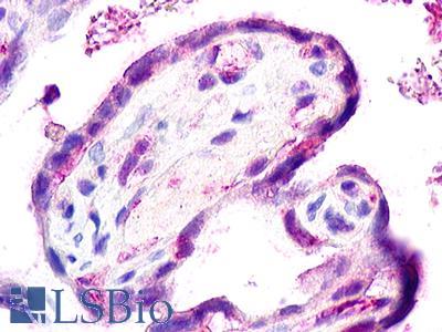 Anti-CCBP2 / D6 antibody IHC of human placenta. Immunohistochemistry of formalin-fixed, paraffin-embedded tissue after heat-induced antigen retrieval. Antibody LS-A365 dilution 24 ug/ml.
