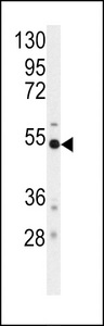 Western blot of anti-BACE Antibody (S498) in mouse cerebellum tissue lysates (35 ug/lane). BACE (arrow) was detected using the purified antibody.