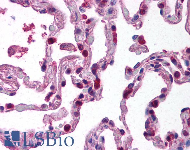 Anti-BACE2 antibody IHC of human lung. Immunohistochemistry of formalin-fixed, paraffin-embedded tissue after heat-induced antigen retrieval. Antibody LS-B744 concentration 20 ug/ml.