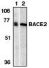 Western blot of BACE2 (NT) antibody (LS-B744) at 1 ug/ml on human (1) and mouse (2) heart tissue lysate.