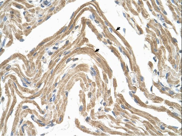 CCBP2 / D6 antibody LS-C40286 was used in IHC to stain formalin-fixed, paraffin-embedded human muscle.