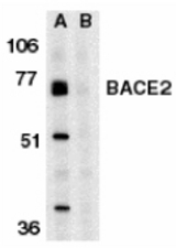 Western blot of BACE2 in human heart tissue lysate in the absence (A) or presence (B) of blocking peptide with BACE2 antibody at 1 ug/ml.