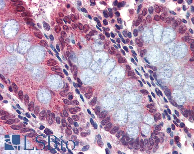 Anti-BACE2 antibody IHC of human colon. Immunohistochemistry of formalin-fixed, paraffin-embedded tissue after heat-induced antigen retrieval. Antibody LS-B3747 concentration 5 ug/ml.