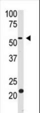 The anti-BACE2 Ctr antibody is used in Western blot to detect BACE2 in HL60 cell lysate.
