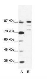 A: Marker, B: Jurkat Cell Lysate