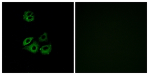 Immunofluorescence of A549 cells, using CCBP2 Antibody. The picture on the right is treated with the synthesized peptide.